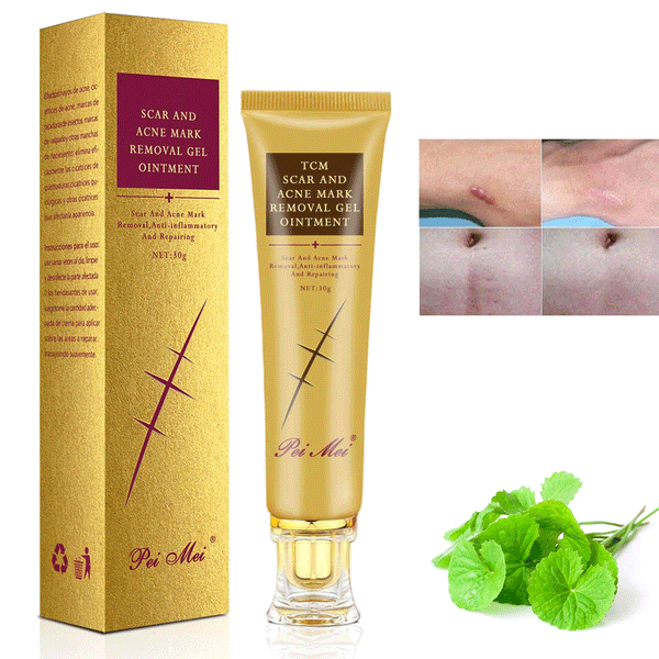 Pei Mei Scar, Stretch And Acne Mark Removal Gel Ointment