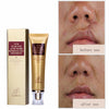  Lanbena TCM SCAR AND ACNE MARK REMOVAL GEL OINTMENT 30g